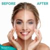 Dead Sea Mud Mask for Face & Body, Exfoliating Spa Treatment for Acne & Skin Problems by Nysa-9 - Thumbnail Image 7