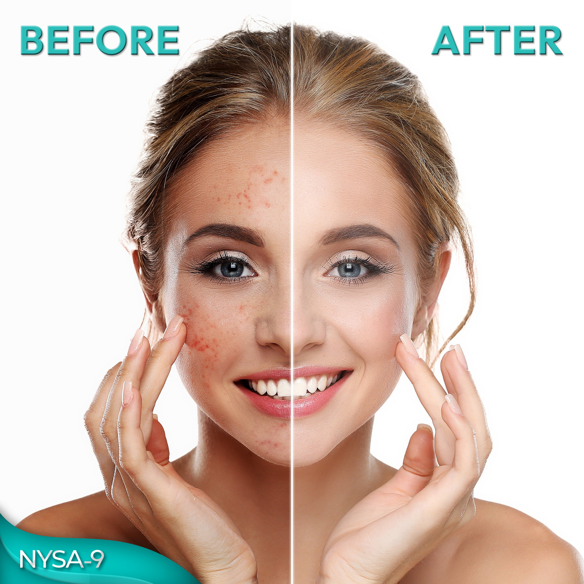 Dead Sea Mud Mask for Face & Body, Exfoliating Spa Treatment for Acne & Skin Problems by Nysa-9 - Image 7