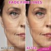 Retinol Serum(2 Pack), Anti-Aging Face Treatment for Fine Lines & Wrinkles by Nysa-9 - Thumbnail Image 5